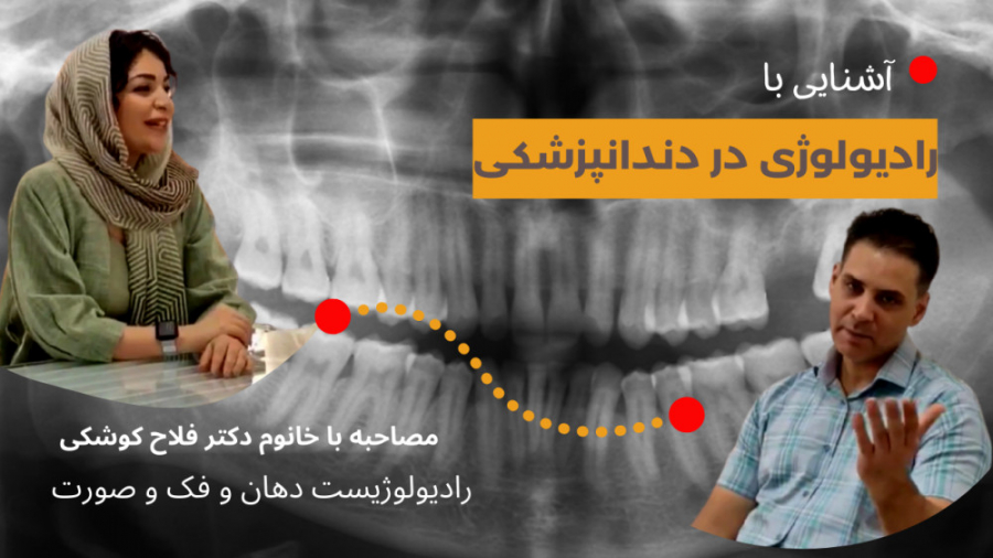 آشنایی با رادیولوژی دندانپزشکی درمان سلولیت