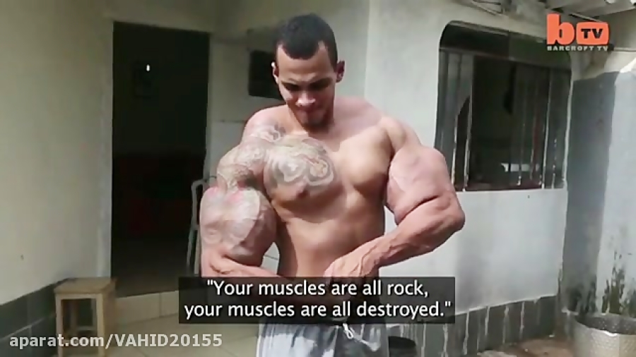 Synthol Buttock Injections