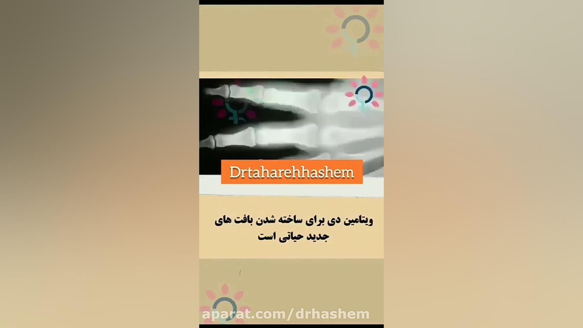 علائم کمبود ویتامین D آکنه