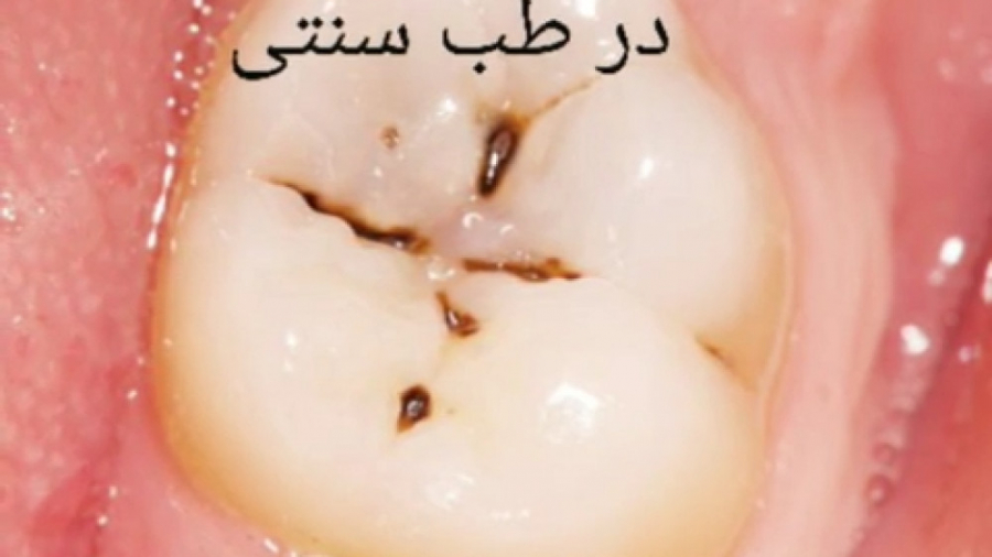 پرسش و پاسخ با استاد محمدرضا صفاری: راهکار پرکردن دندان در طب سنتی ایمونولوژی محاسباتی