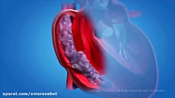 انیمیشن سیستم گردش خون