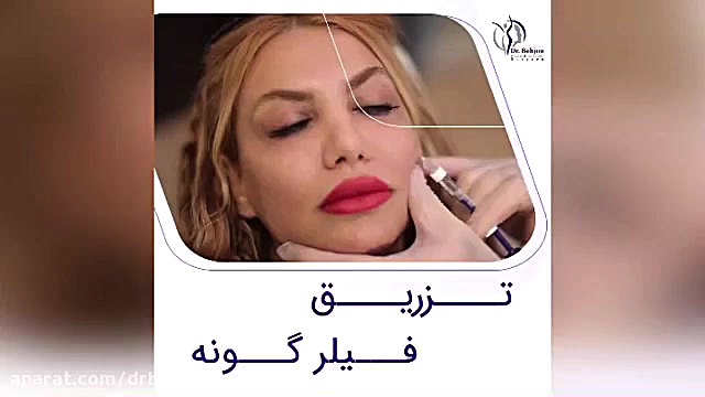 فیلم واقعی تزریق فیلر گونه دکتر شاهین بهجو - فوق تخصص جراحی پلاستیک