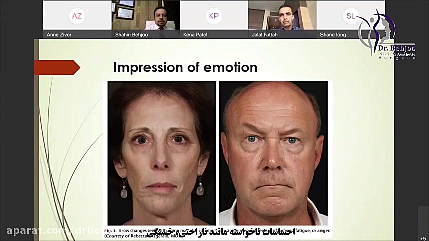 روشی نوین برای لیفت پیشانی و ابرو در وبینار لندن ۲۰۲۱ - 1 دکتر شاهین بهجو - فوق تخصص جراحی پلاستیک