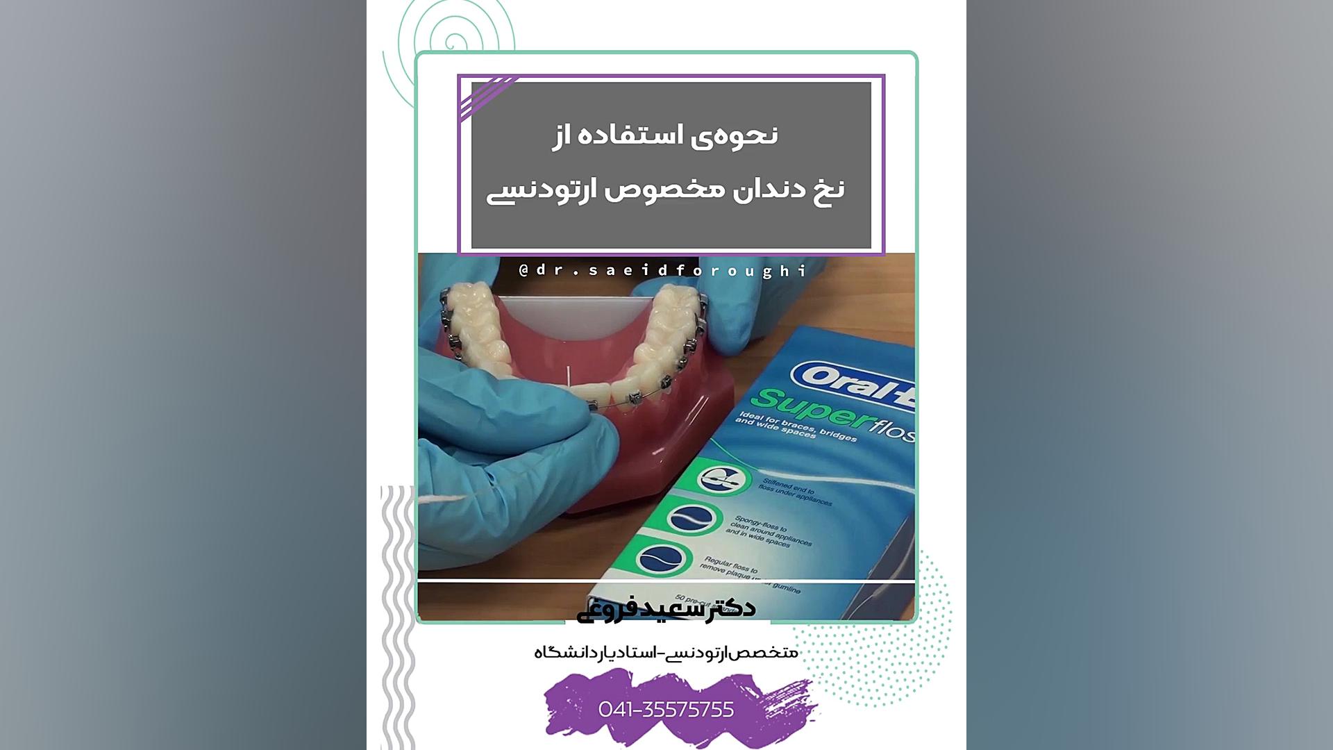 نحوه استفاده ار نخ دندان مخصوص ارتودنسی دکتر سعید فروغی متخصص ارتودنسی