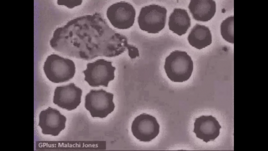 حمله wbc به باکتری درون خون ساندرا بولاک