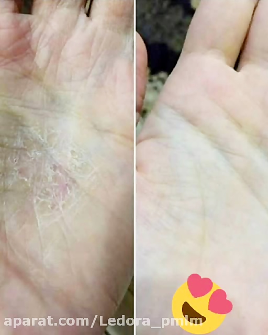 کرم هلث نوشن معجزه دست و صورت09144504618