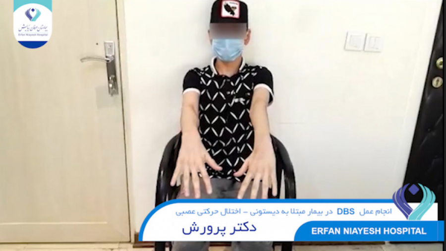 1400.07.17 - انجام عمل (DBS) در بیمار مبتلا به دیستونی - اختلال حرکتی عصبی جواد عزتی