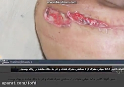 گلوله تک تیرانداز ایرانی صیاد...