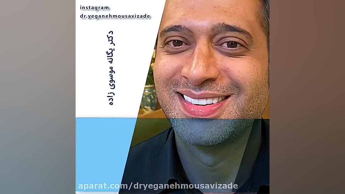 اصلاح طرح لبخند اریتروبلاستوز جنینی