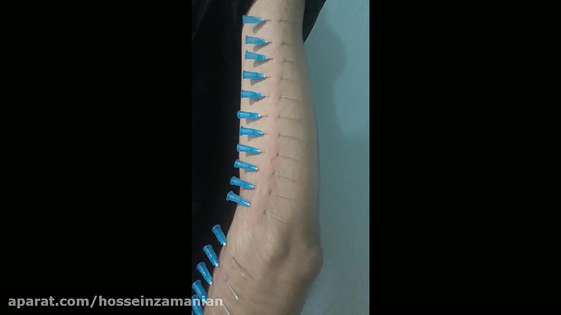 کنترل درد . نیروی درون . چشم سوم . انرژی درون .قدرت ذهن انسان ( زمانیان ) پرتاب نعل
