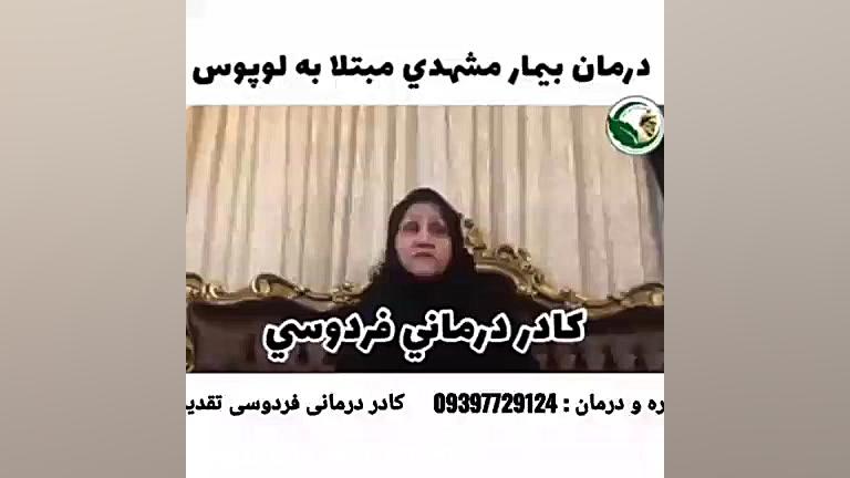 درمان لوپوس به صورت 100%تضمینی و بدون بازگشت و بدون عوارض جانبی پر کردن دندان