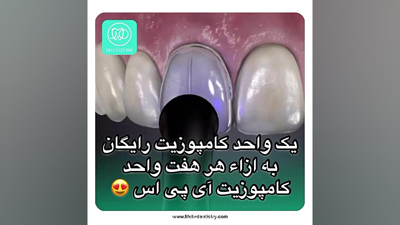 جشنواره (۸=۷) یا ۱ واحد کامپوزیت رایگان واقعیه ؟ سینتولاژوماب