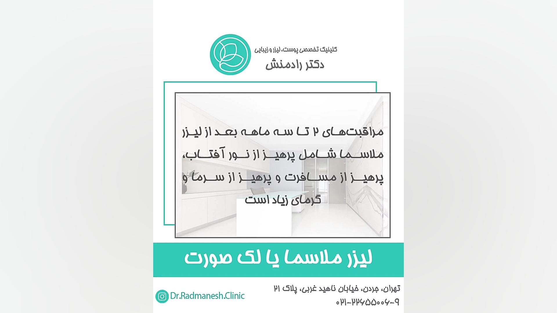 لیزر ملاسما یا لک صورت رفع غبغب