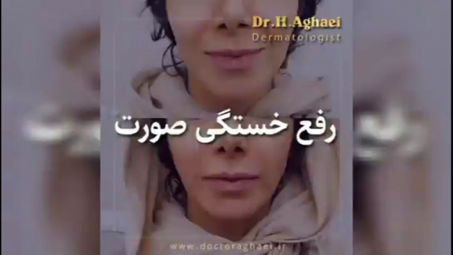 بهترین راهکار رفع خستگی صورت دکتر حمیده آقایی