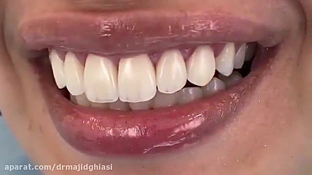 اصلاح طرح لبخند با درمانهای ترکیبی دکترمجیدقیاسی