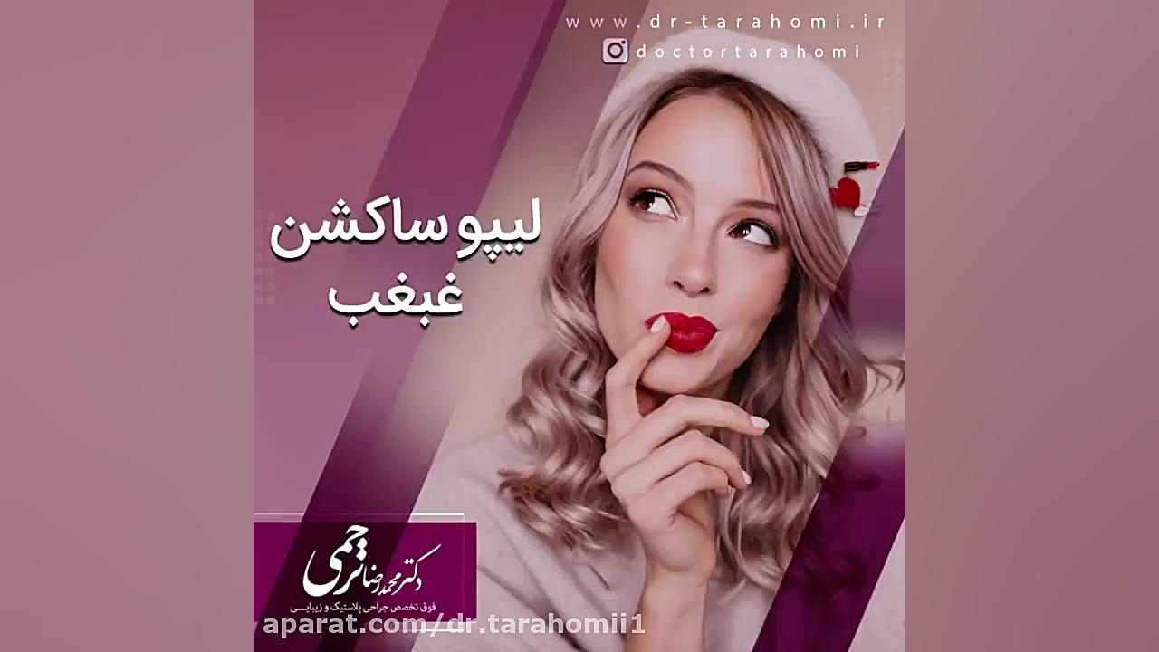 انیمیشن لیپوساکشن غبغب جوانسازی پوست