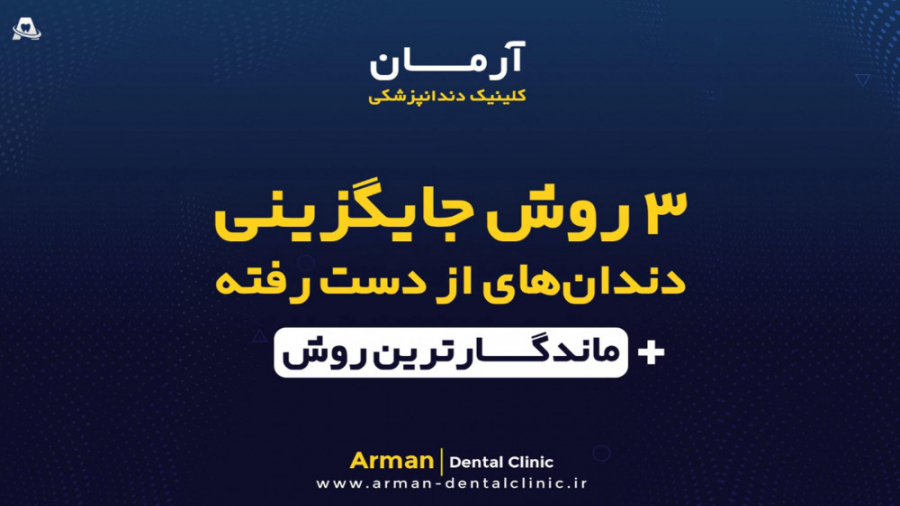 3 روش جایگزین دندان از دست رفته - ایمپلنت دندان کاشت ریش