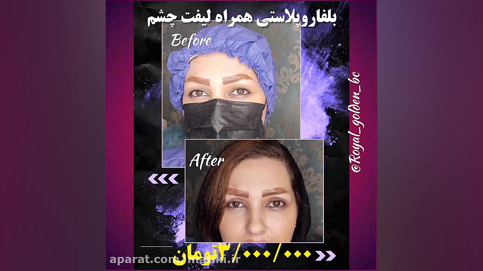 کلینیک تخصصی پوست، مو و لیزر رویال طلایی Meta-Transcriptomics