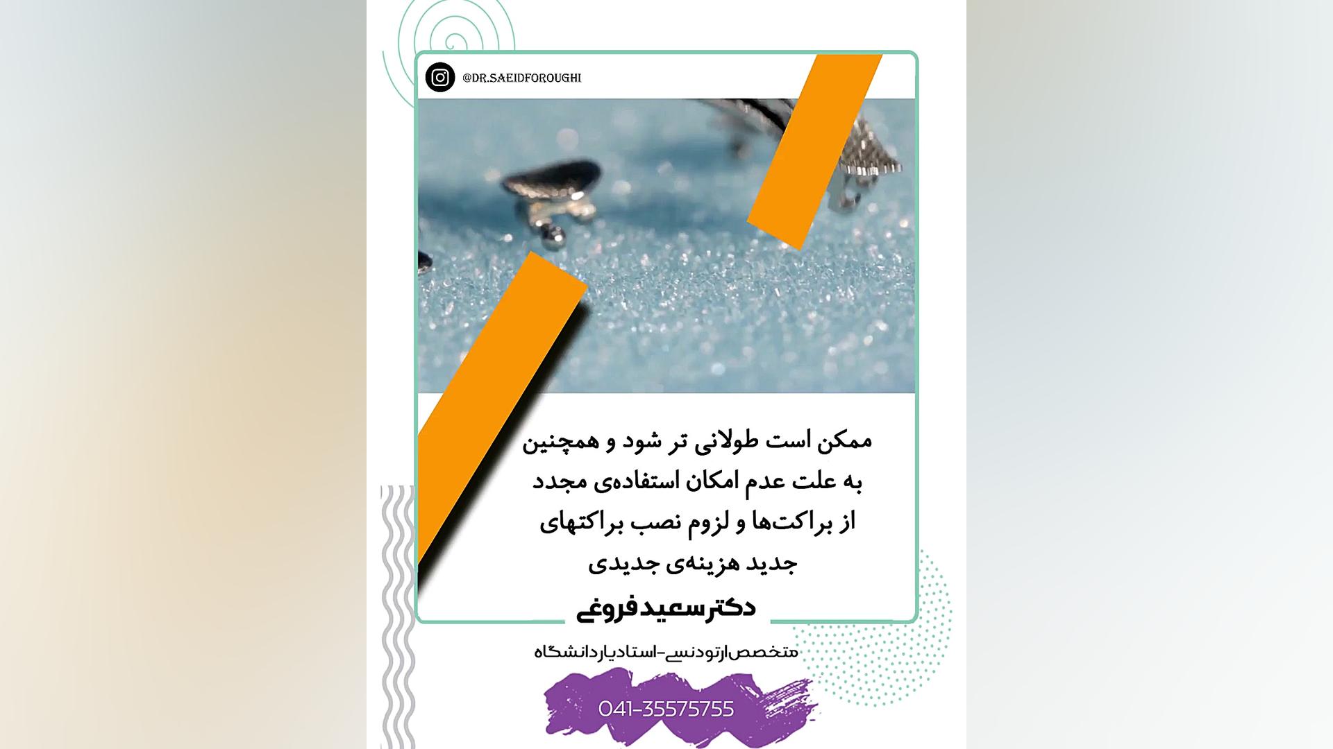 امکان برداشتن موقتی براکت های ارتودنسی دکتر سعید فروغی متخصص ارتودنسی