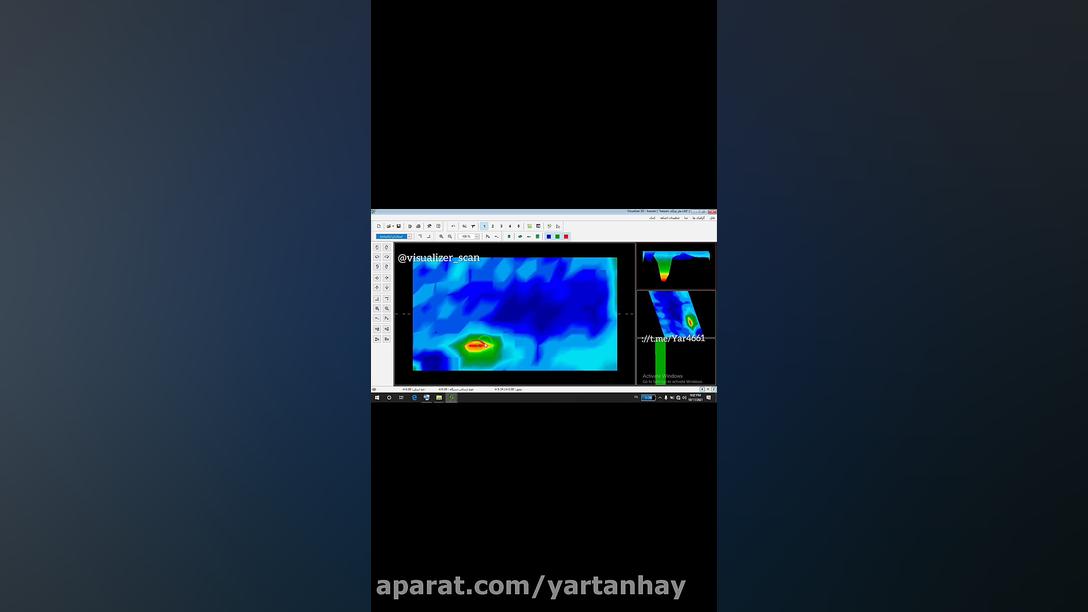 اموزش انالیز و تحلیل اسکن فلز در ویژوالایزر اسکنر تصویری visualizer okm جراحی پف زیر چشم