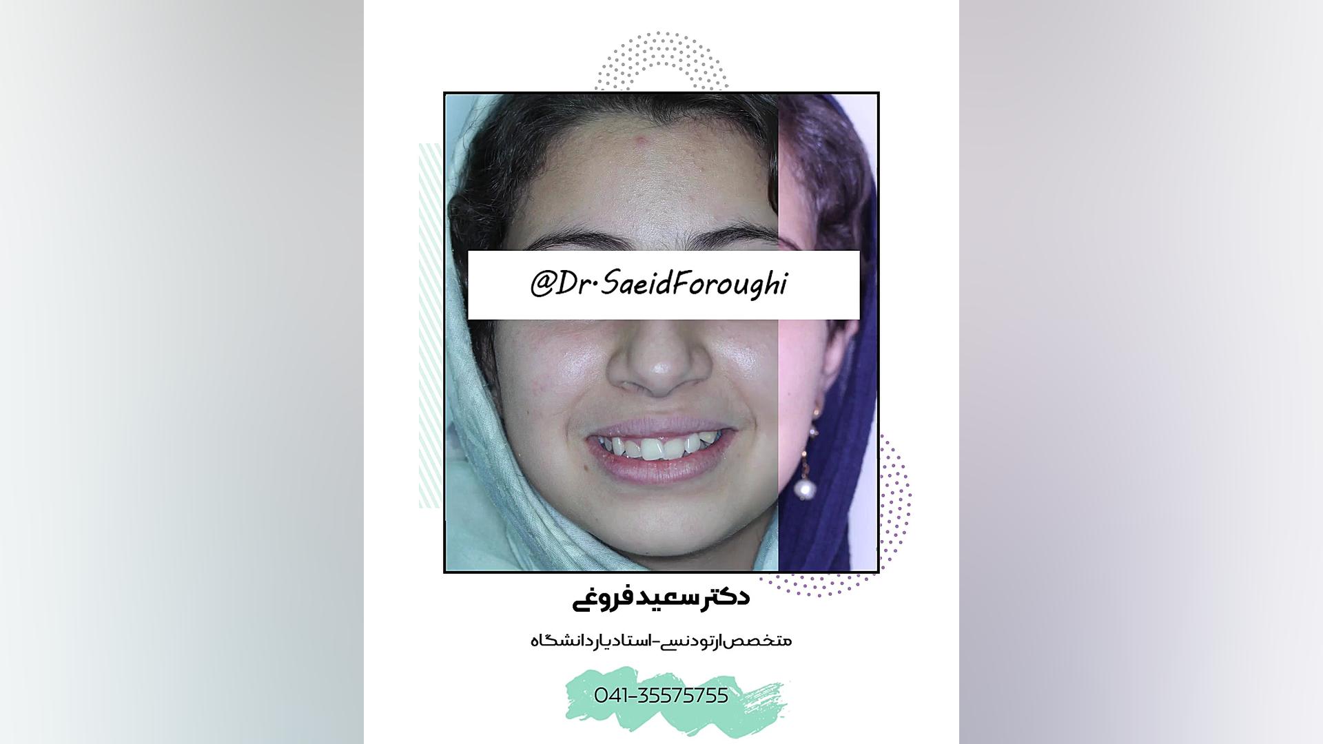 ارتودنسی دندان دکتر سعید فروغی متخصص ارتودنسی