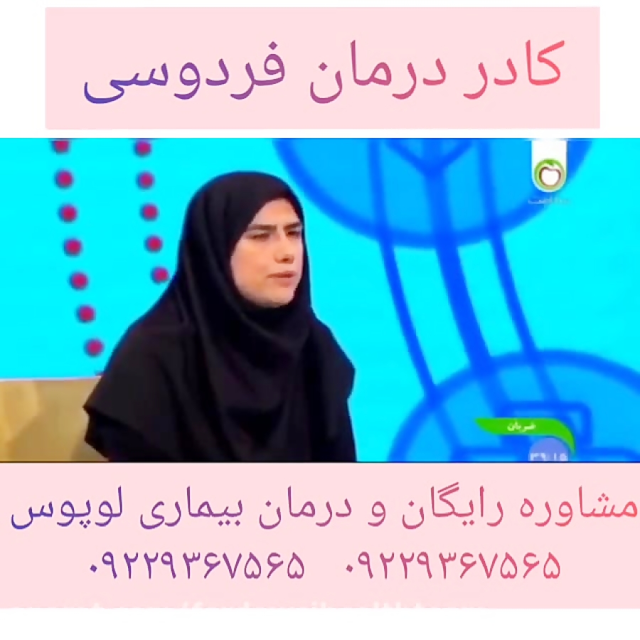 مشاوره و درمان بیماری لوپوس توسط کادر درمان فردوسی مشاوره و درمان بیماری لوپوس توسط کادر درمان فردوسی