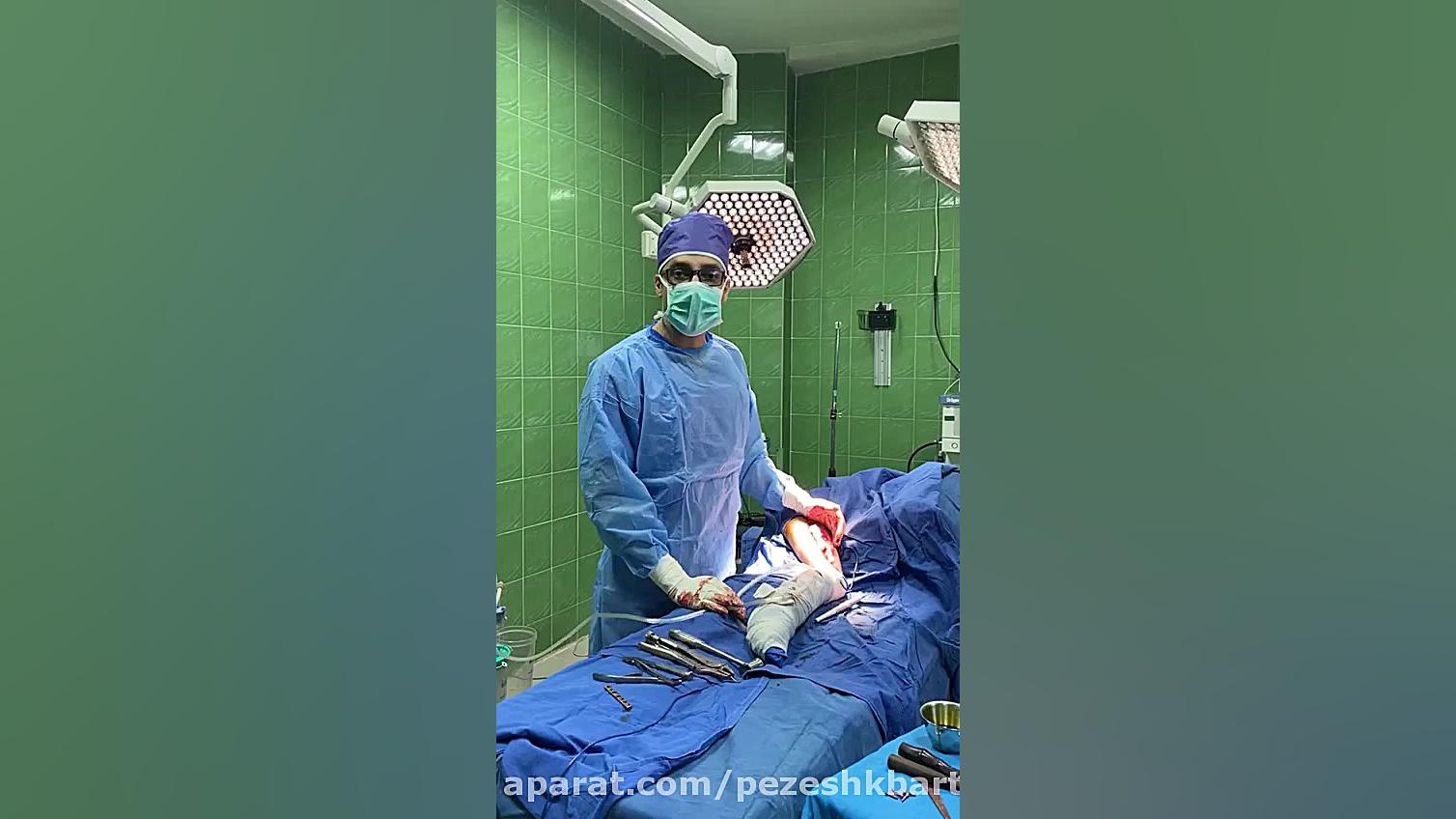دکتر علی حسین پور فیضی متخصص و جراح ارتوپدی درمان جای جوش
