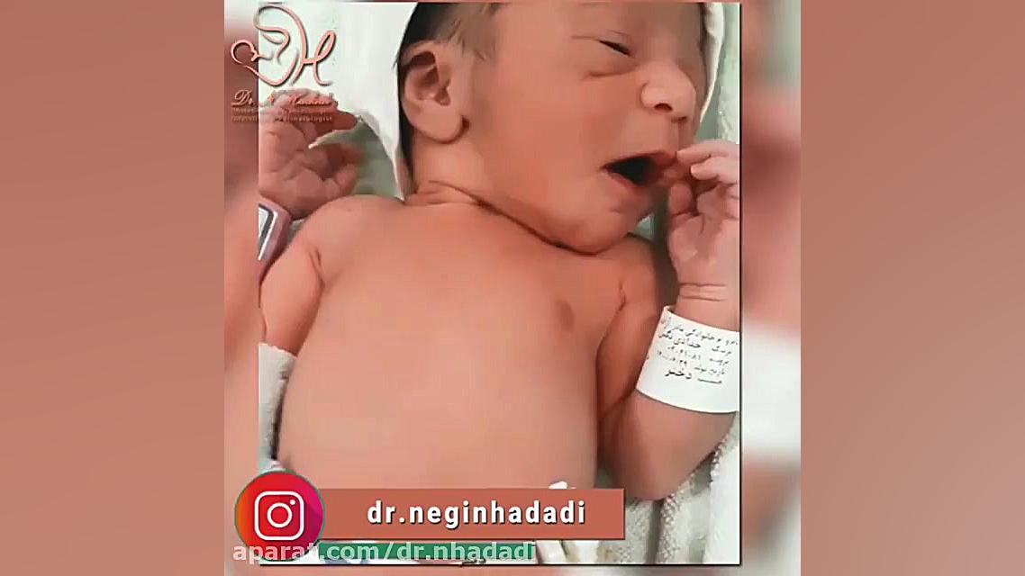فیلم اتاق عمل زایمان سزارین ملودی جون پروتز سینه