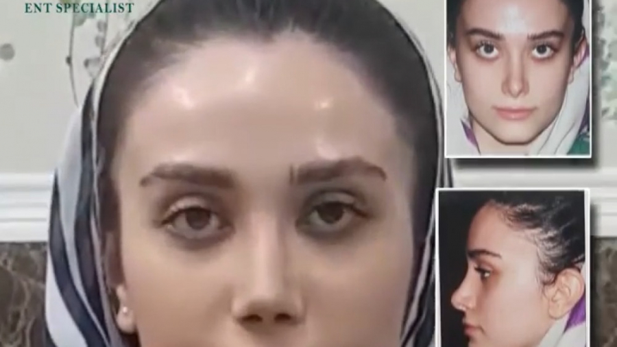 عمل بینی ترمیمی در لرستان دکتر فاطمه مختاری فر جراح بینی در لرستان