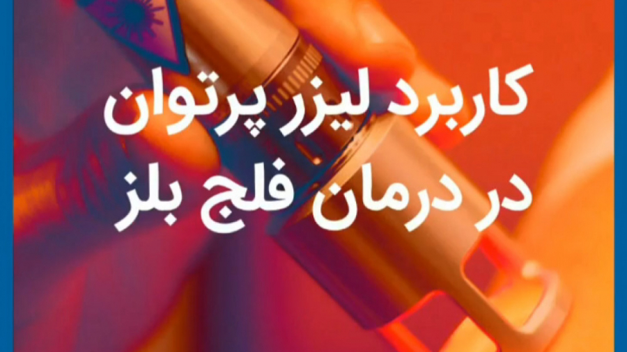 کاربرد لیزرپرتوان در فیزیوتراپی فلج بلز تزریق چربی