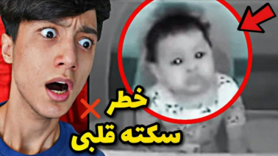 ببینید این بچه چه بلایی سرش اومد | خطر سکته قلبی ابرسانی پوست