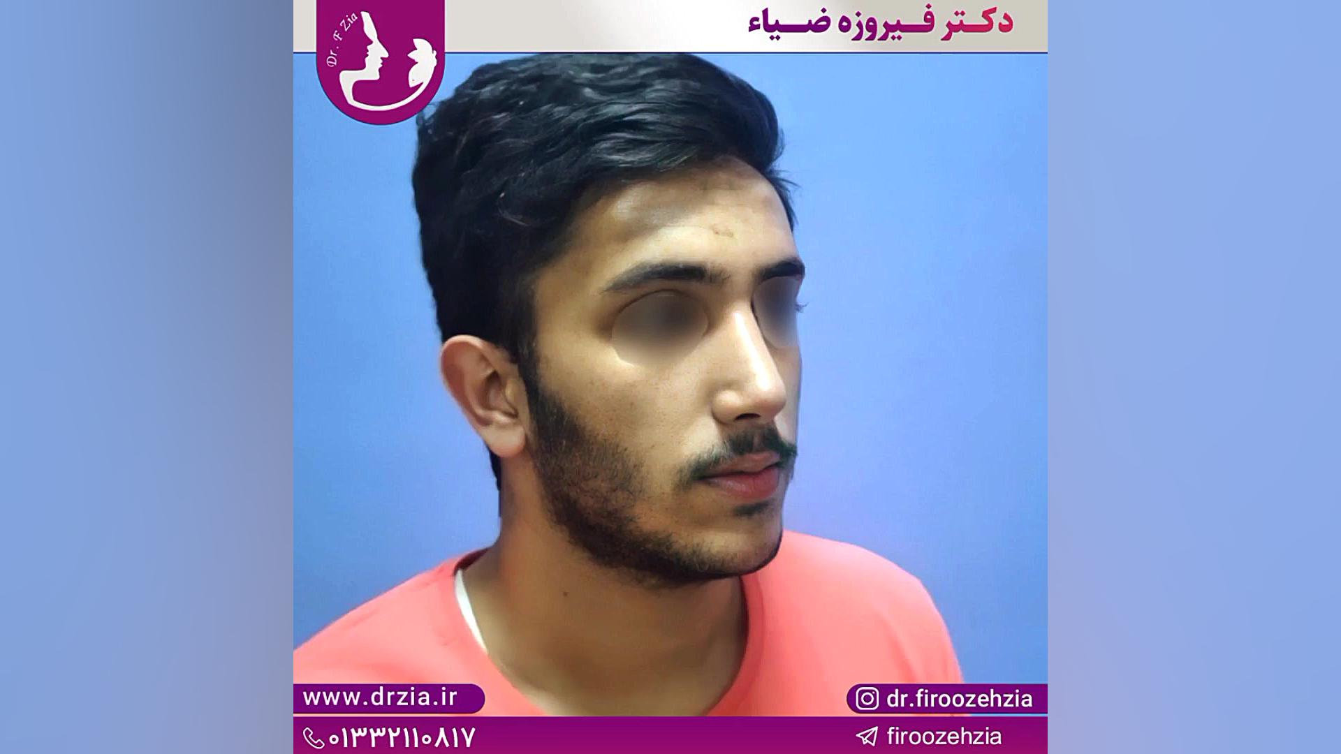 جراح و متخصص گوش حلق و بینی کاشت ریش