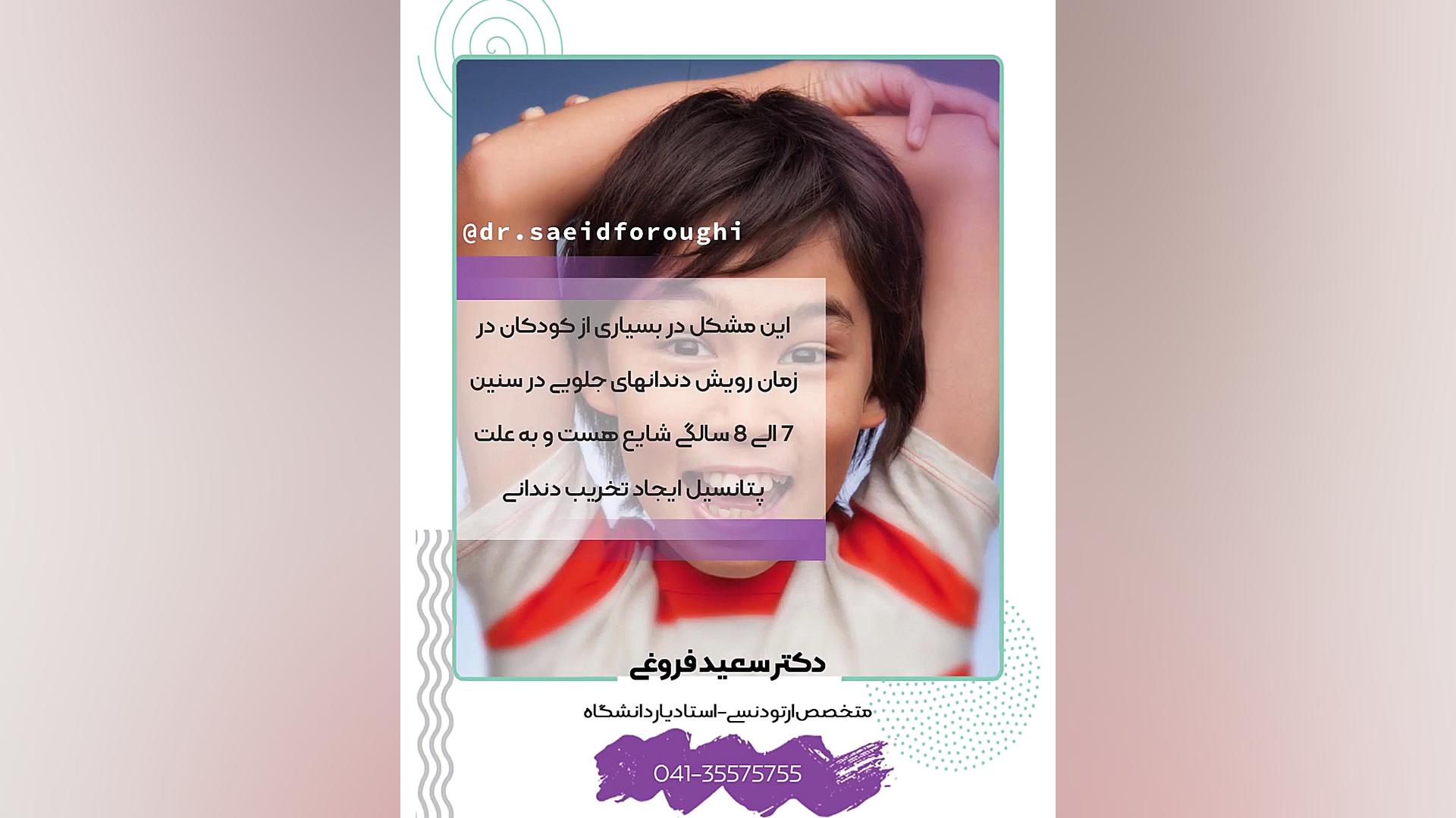 کراس بایت دندانی قدامی دکتر سعید فروغی متخصص ارتودنسی