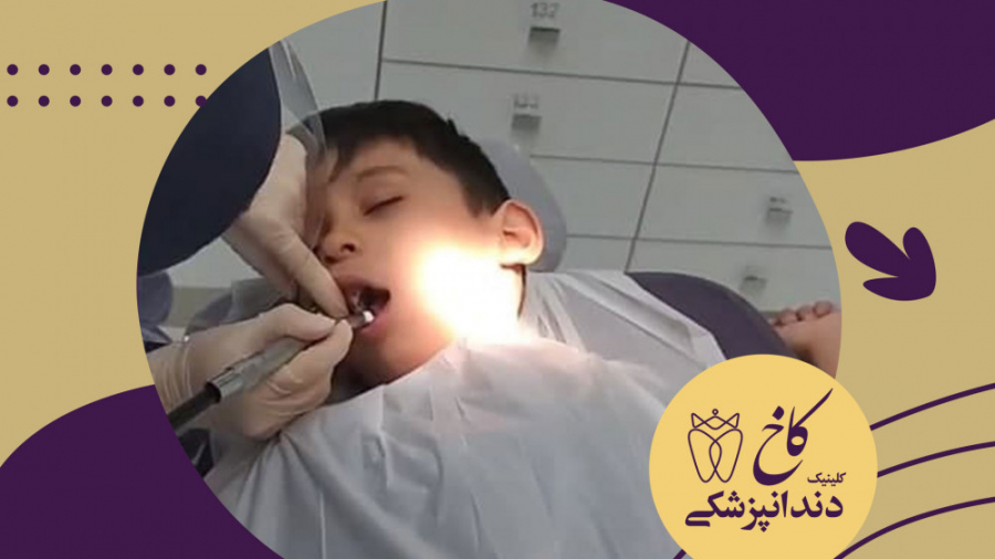 دندانپزشکی تحت بیهوشی برای کودکان کلینیک دندانپزشکی کاخ