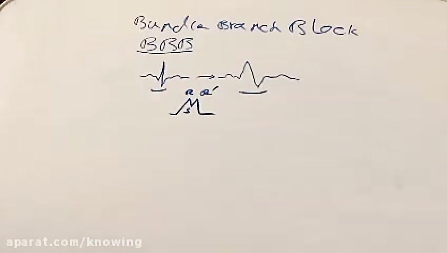 تفسیر ECG (بلوک شاخه ای) جراحی پف زیر چشم