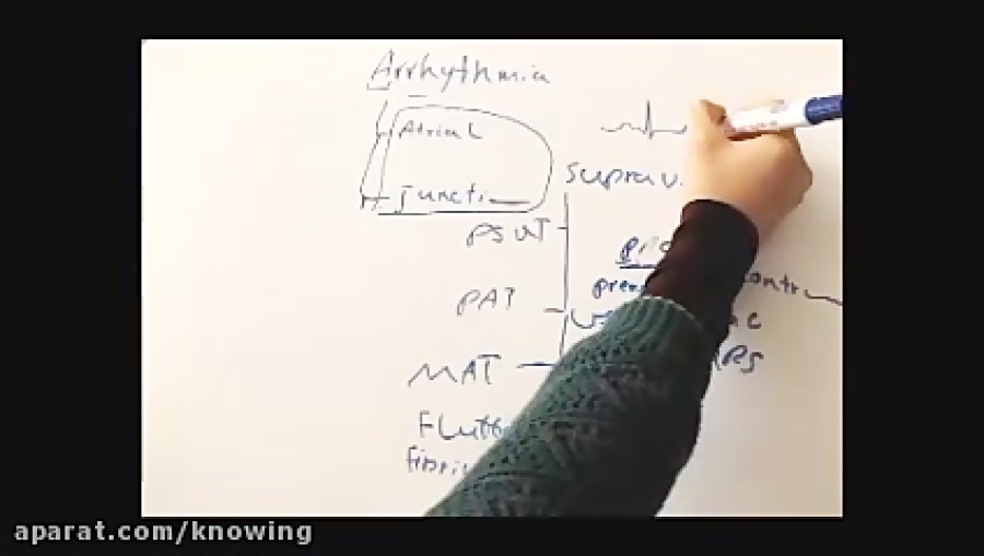 تفسیر ECG (آریتمی فوق بطنی) دکتر پوست