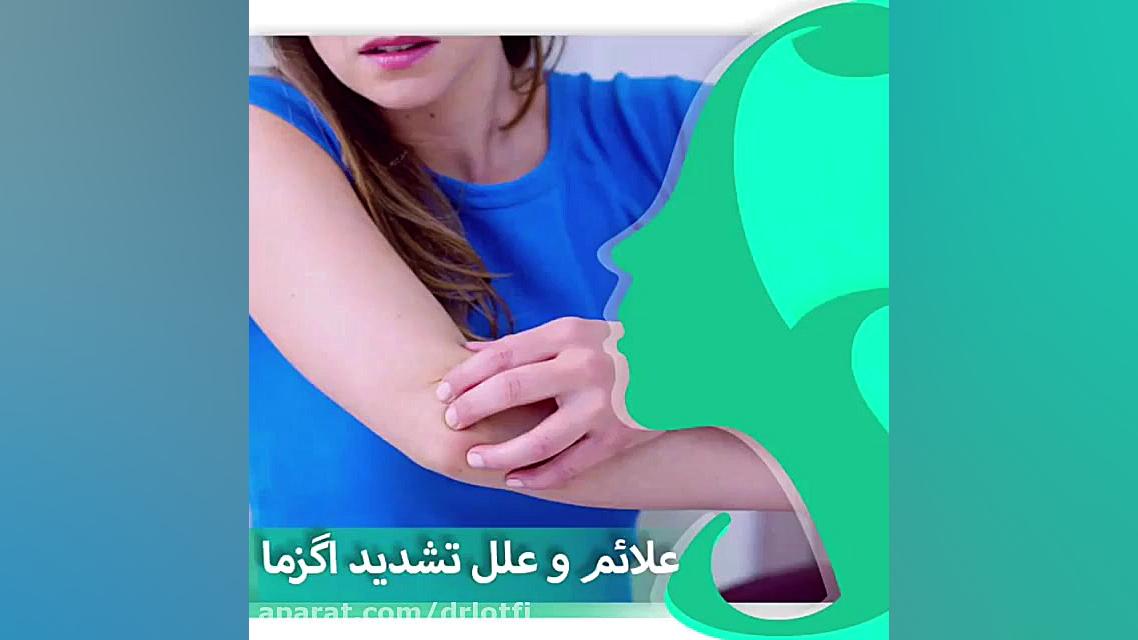 علائم و علت تشدید اگزما پوستی را بدانید دکتر سار ا لطفی
