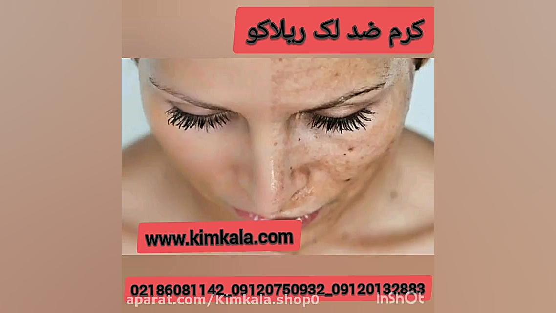 خواص کرم ضد لک قوی ریلاکو/۰۹۱۲۰۷۵۰۹۳۲ کلینیک پوست