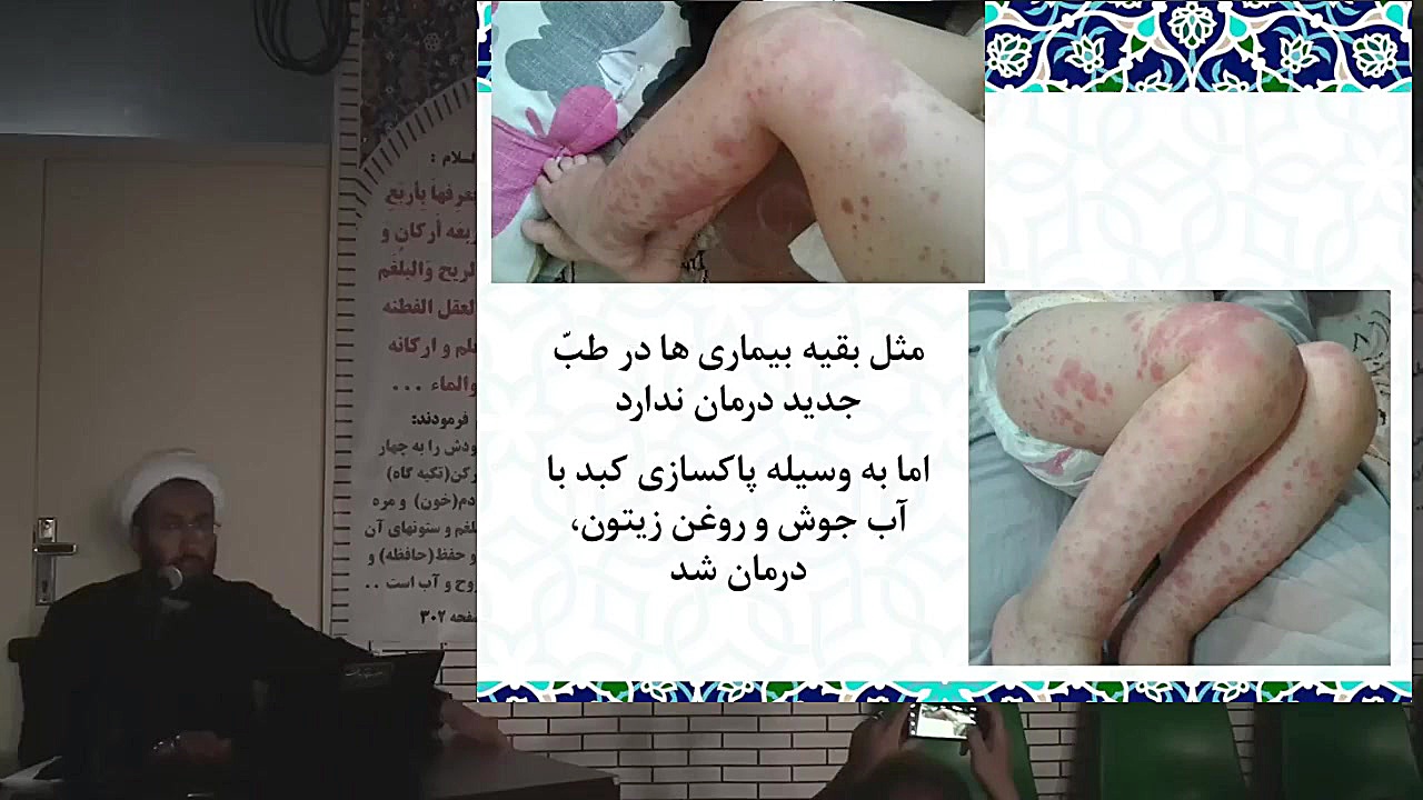 کبد و پوست هنوخ اگزما پسوریازیس کهیر خارش شوره سر سیروز کبدی سرطان کبدی اتوپلاستی