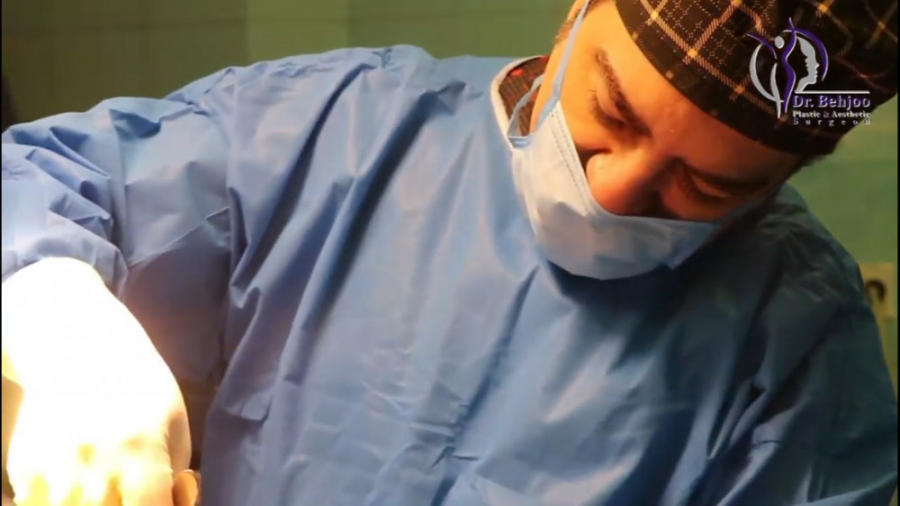 فیلم روش های مختلف پیکرتراشی دکتر شاهین بهجو - فوق تخصص جراحی پلاستیک