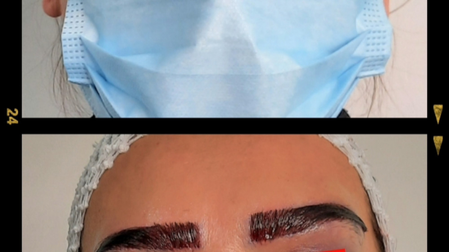 کاشت ابرو 18 ( مرکز تخصصی کاشت مو / ابرو لیان ) اندودنتیکس