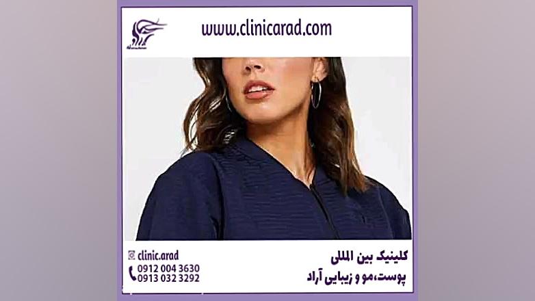 قیمت عمل زیبایی واژن دستگاه لیزر پالس فمتوثانیه