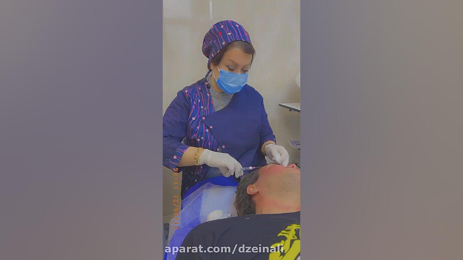 تزریق فیلر برای رفع چروکها و گودیهای پیشانی دکتر فرحناز زینعلی - متخصص پوست، مو، زیبایی زنجان