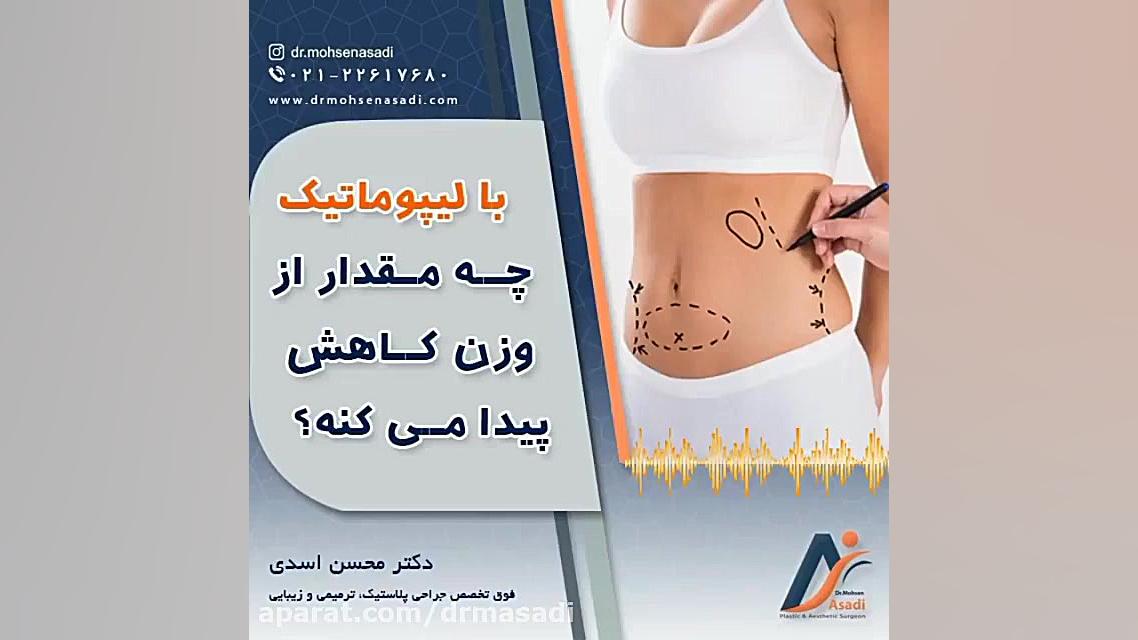 میزان کاهش وزن با لیپوماتیک سلفی کله‌معمولی