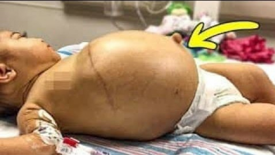 دکتر ها در درون شکم یک نوزاد, یک بچه ی دیگر پیدا کردند دنزل واشینگتن