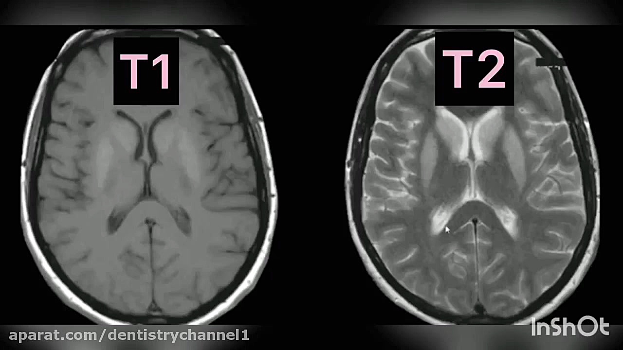 شناسايی تصاير MRI ( دکتر اخشته ) گیم لولو