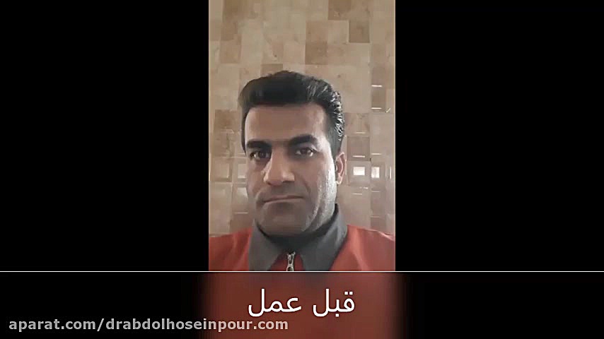 جراحی صورت در اسپاسم عضلات صورت بازی کامپیوتری
