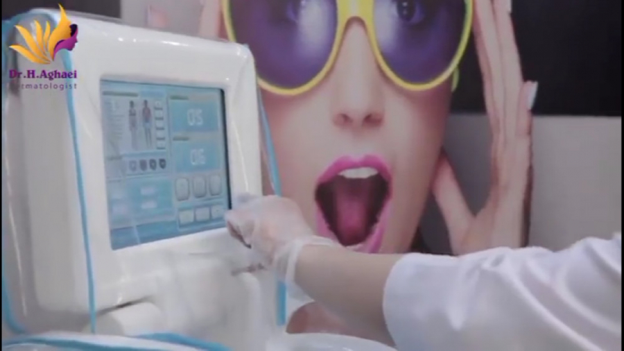 فیلم لیزر موهای زائد در مطب دکتر آقایی دکتر حمیده آقایی