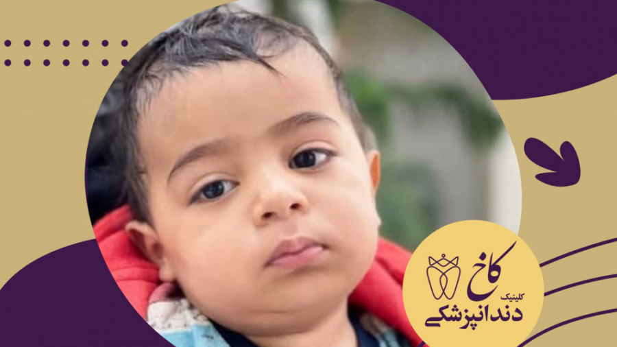 دندانپزشکی تحت بیهوشی اطفال کلینیک لیزر