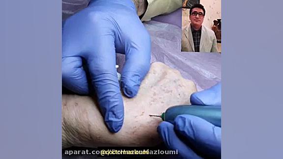 "لنتیگو" دکتر سید حسن مظلومی رضا عطاران